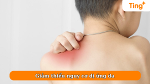 Giảm thiểu nguy cơ dị ứng da